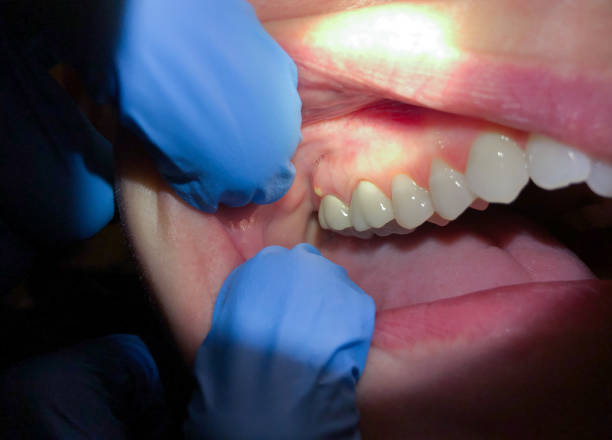 Best Cosmetic Emergency Dentistry in Bridgeport, IL
