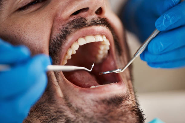Best Emergency Tooth Extraction in Bridgeport, IL