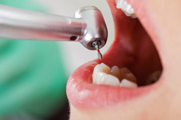 Best Weekend Emergency Dentist in Bridgeport, IL